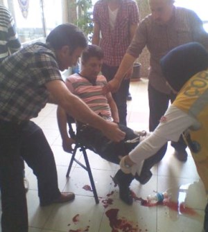 Çorum Adliye Önünde Bıçaklı Kavga1 Kişi Yaralandı