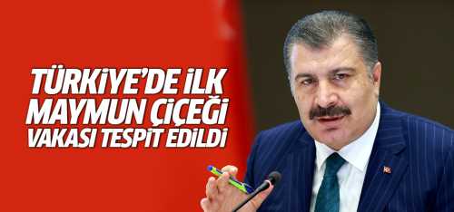 Bakan ilkkez maymun çiçeği vakası tespit edildi açıklaması yaptı