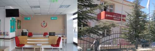 Çorum'a tam donanımlı diş hastanesi geliyor