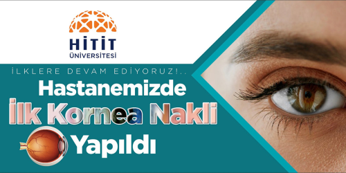 Çorum HİTÜ' de ilk kez Göz nakli gerçekleşti