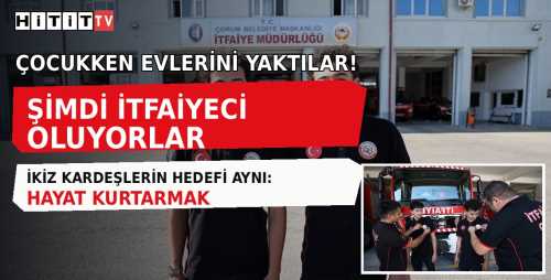 Çorumlu İkizlerin İlginç Hikâyesi