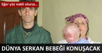 DÜNYA SERKANIN YÜZ NAKLİNİ KONUŞUCAK