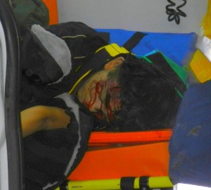 Direksiyon Hakimiyetini  kaybeden Otomobil Uçuruma Yuvarlandı: 1 Ölü, 2 Yaralı