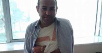 SUNGURLU AK PARTİ İL GENEL MECLİS ÜYESİ KAZA GEÇİRDİ