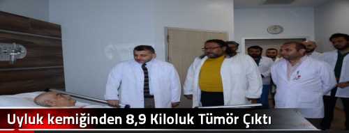 Uyluk kemiğinden 8,9 Kiloluk Tümör Çıktı