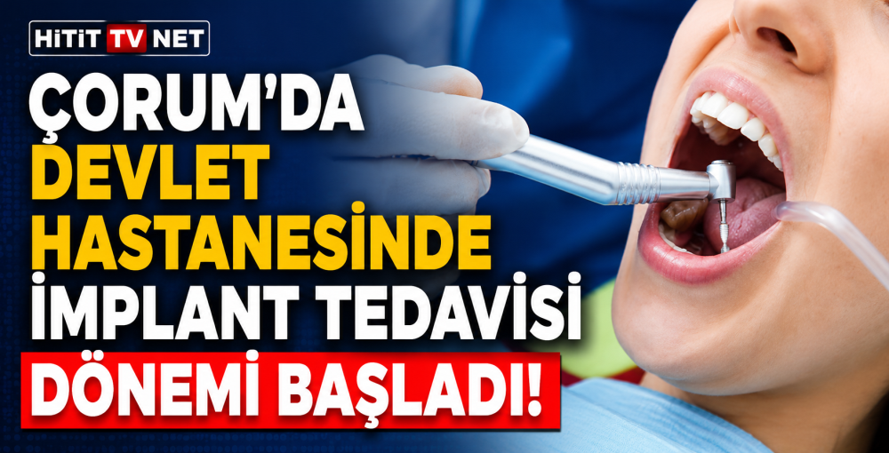 Çorum'da Devlet Hastanesinde İmplant Tedavisi…